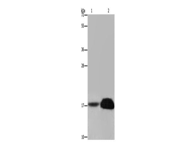 FHIT Polyclonal Antibody Store at -20°C