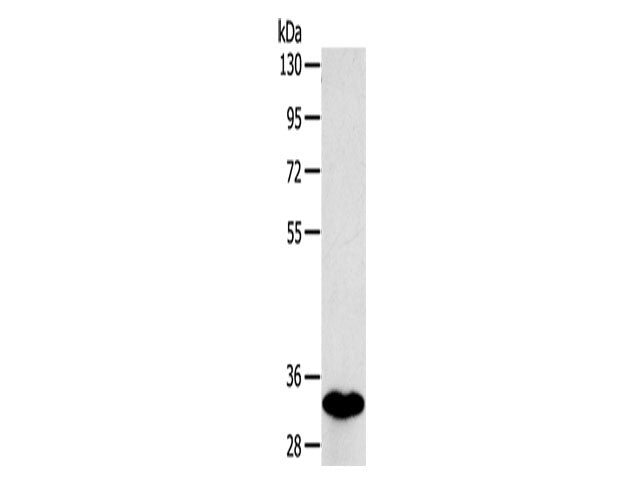 SULT1B1 Polyclonal Antibody Store at -20°C