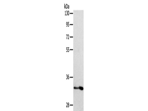 ST2 Polyclonal Antibody Store at -20°C