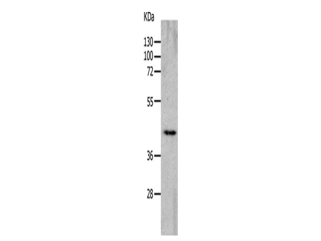 CHRNA7 Polyclonal Antibody Store at -20°C