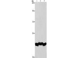 PGK1 Polyclonal Antibody Store at -20°C