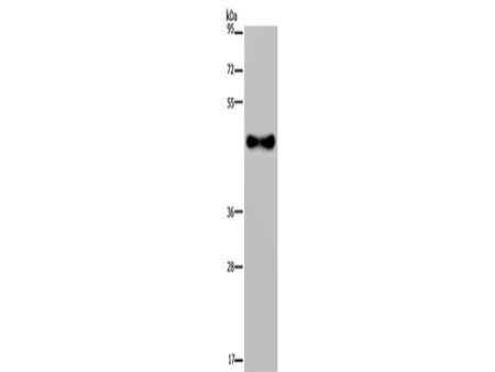 FADS1 Polyclonal Antibody Store at -20°C