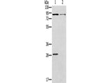 CNGA3 Polyclonal Antibody Store at -20°C