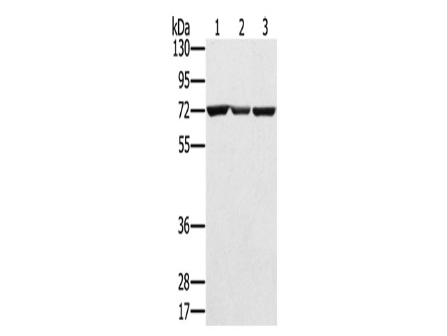 SLC25A13 Polyclonal Antibody Store at -20°C
