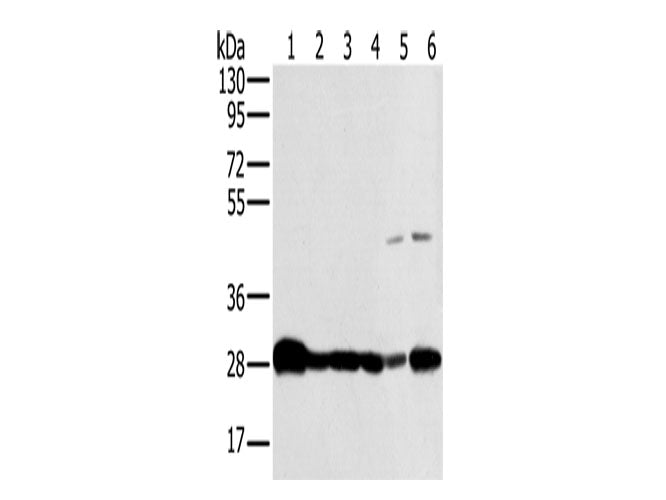 NDUFS3 Polyclonal Antibody Store at -20°C