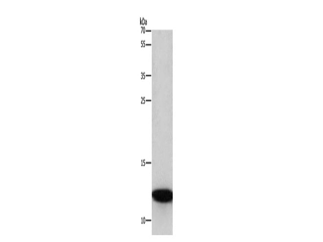 BRK1 Polyclonal Antibody Store at -20°C