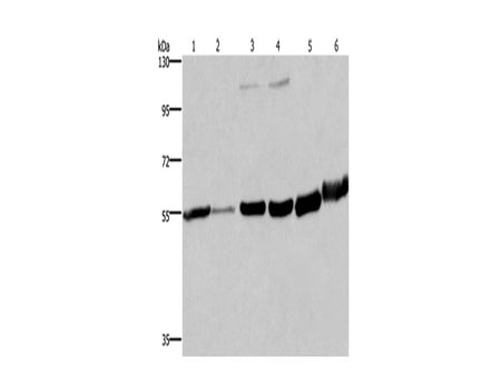 MCHR1 Polyclonal Antibody Store at -20°C