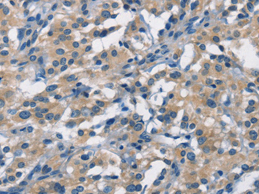APOL1 Polyclonal Antibody Store at -20°C