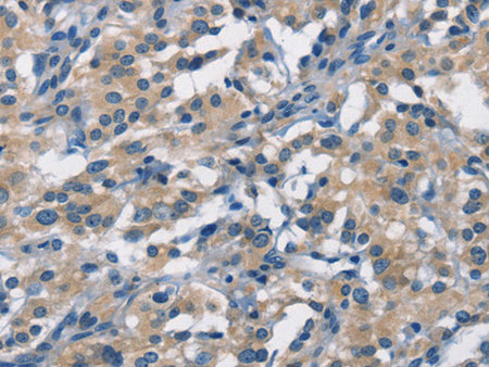 APOL1 Polyclonal Antibody Store at -20°C