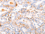 ABCA4 Polyclonal Antibody