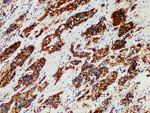 ACTH Monoclonal Antibody Stored at -20°C