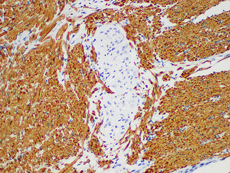 Actin pan Monoclonal Antibody Stored at -20°C
