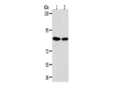 ADAM11 Polyclonal Antibody Store at -20°C