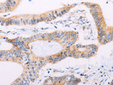 ADAMTS16 Polyclonal Antibody
