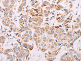 ADAMTS16 Polyclonal Antibody