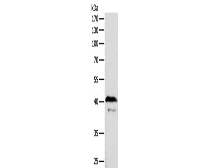 ADAP1 Polyclonal Antibody Store at -20°C