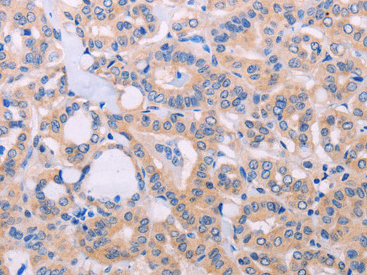 ADCY5 Polyclonal Antibody Store at -20°C