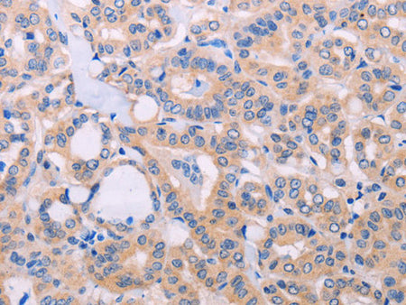 ADCY5 Polyclonal Antibody Store at -20°C