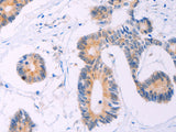 ADCY5 Polyclonal Antibody Store at -20°C