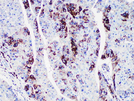 AFP Monoclonal Antibody Stored at -20°C