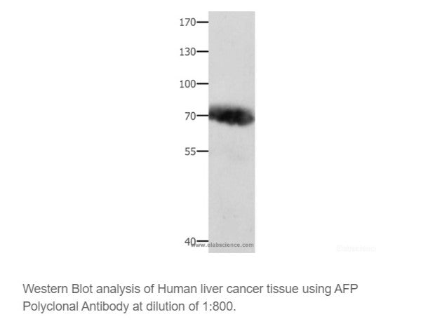 AFP Polyclonal Antibody, Biomarkers, Elabscience Biotechnology, MSE Supplies