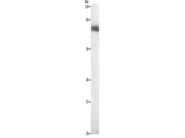 ALB Polyclonal Antibody Store at -20°C