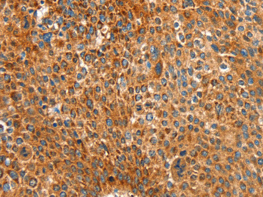 ALDH1A2 Polyclonal Antibody Store at -20°C