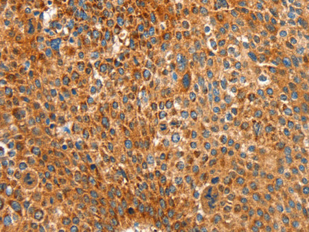 ALDH1A2 Polyclonal Antibody Store at -20°C
