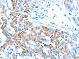 ALDH5A1 Polyclonal Antibody Store at -20°C