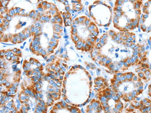 ALDH5A1 Polyclonal Antibody Store at -20°C