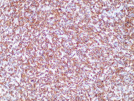 ALK Monoclonal Antibody Stored at -20°C