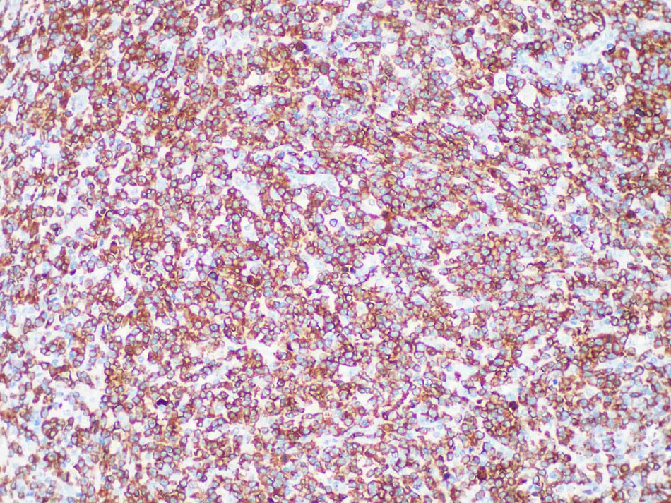 ALK Monoclonal Antibody Stored at -20°C