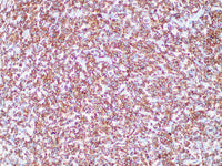 ALK Monoclonal Antibody Stored at -20°C