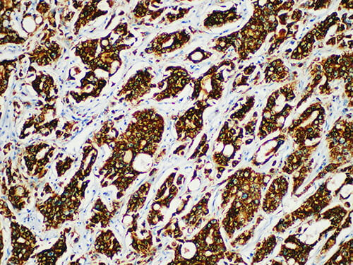 AMACR/p504s Monoclonal Antibody Stored at -20°C | Elabscience Biotechnology