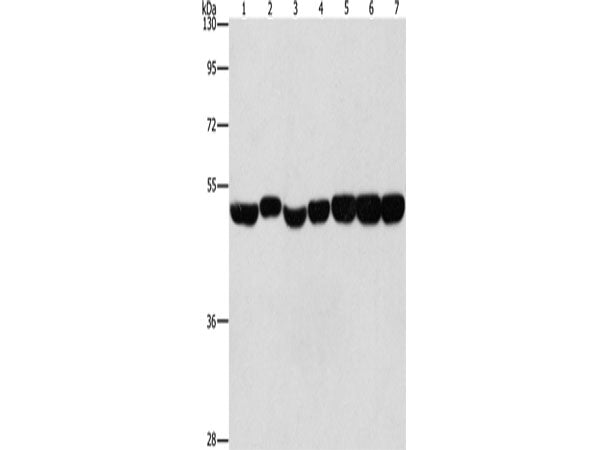 ENO1 Polyclonal Antibody Store at -20°C