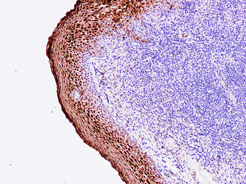 Annexin A1 Monoclonal Antibody Stored at -20°C