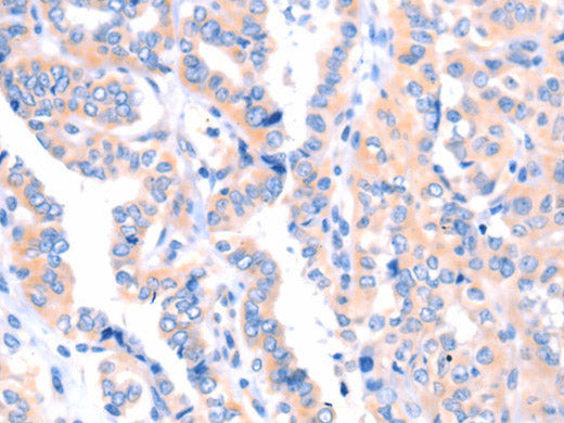 APBA2 Polyclonal Antibody Store at -20°C