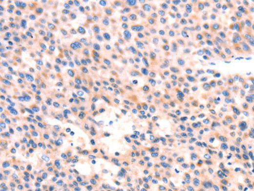 APBA2 Polyclonal Antibody Store at -20°C