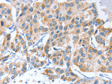 APOBEC3D Polyclonal Antibody