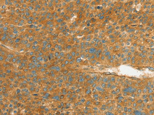 APOL2 Polyclonal Antibody Store at -20°C