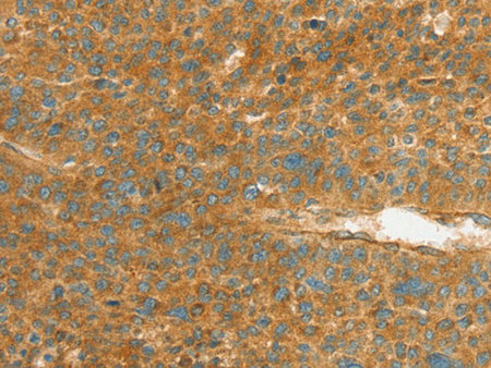 APOL2 Polyclonal Antibody Store at -20°C