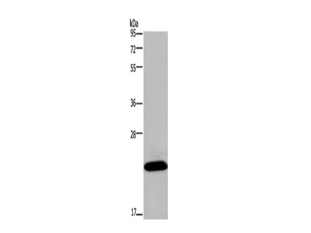 KCNMB4 Polyclonal Antibody Store at -20°C