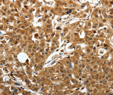 SOX-13 Polyclonal Antibody