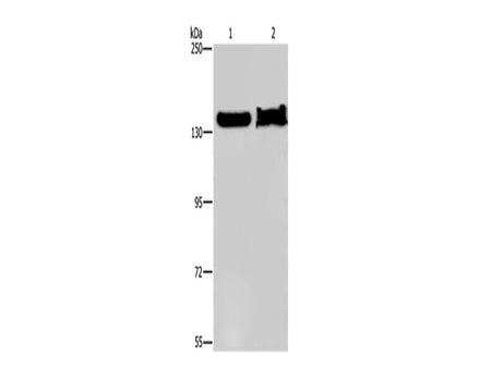 KDM4A Polyclonal Antibody Store at -20°C