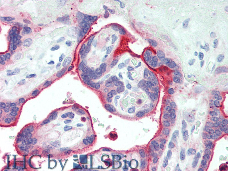 NECTIN4 Polyclonal Antibody Store at -20°C