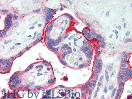 NECTIN4 Polyclonal Antibody Store at -20°C