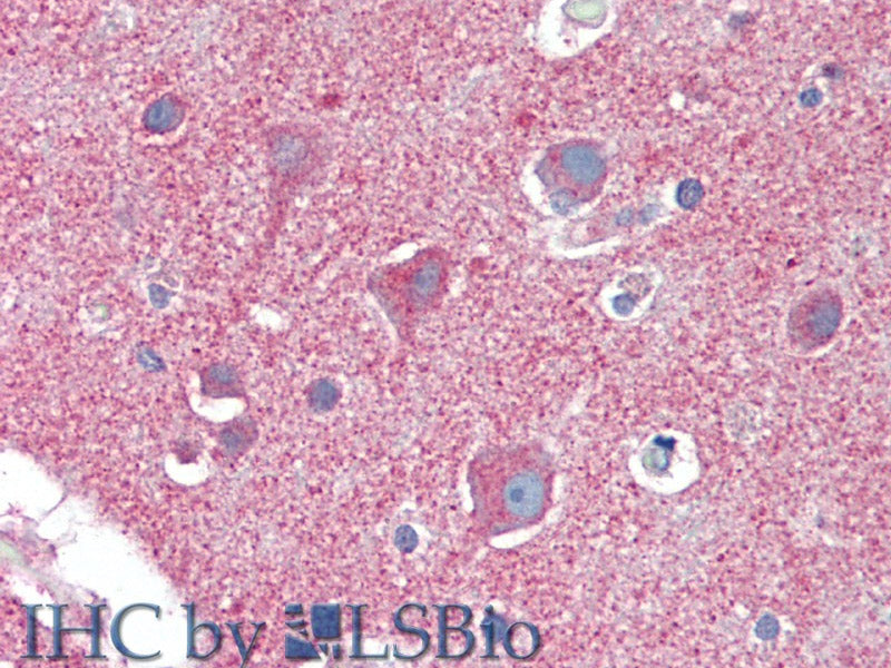 CLTC Polyclonal Antibody Store at -20°C