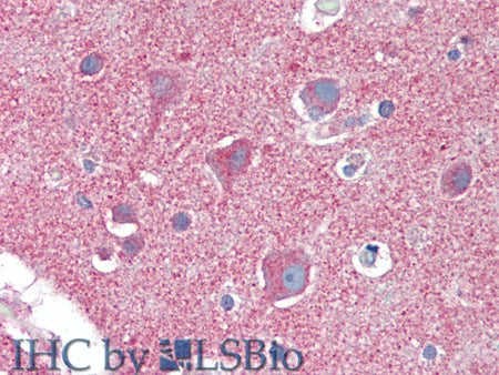 CLTC Polyclonal Antibody Store at -20°C