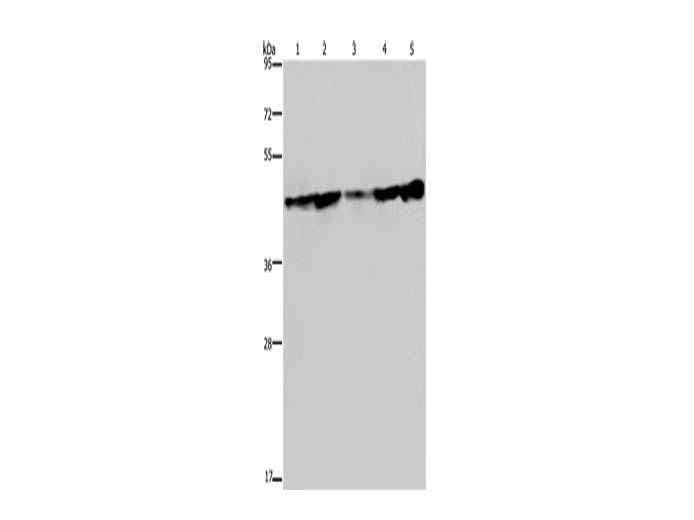 CERS4 Polyclonal Antibody Store at -20°C