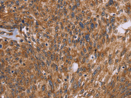 PPIB Polyclonal Antibody Store at -20°C